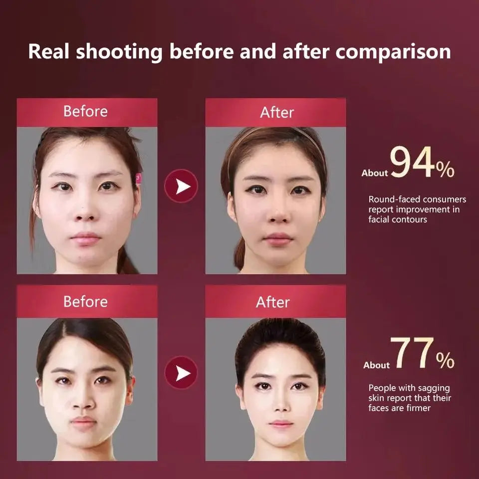 Led Photon wellness Facial Lifting roller